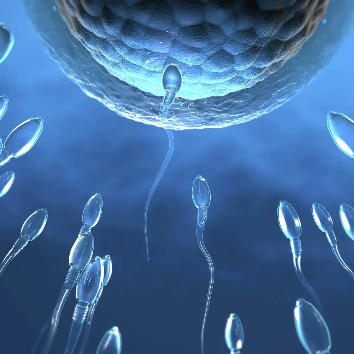 Infertilidade masculina - Dr. Eugênio Rocha